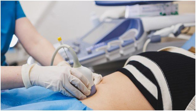 The Process of Pregnancy Ultrasound in Sydney